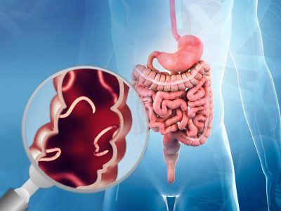 Parasitoses Intestinais